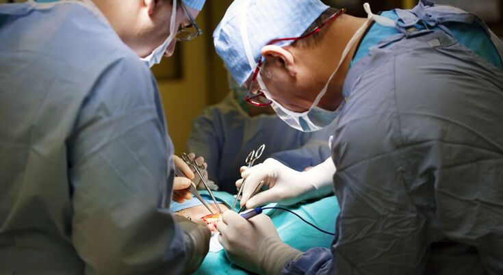La chirurgia viene eseguita negli stadi avanzati della prostatite cronica negli uomini